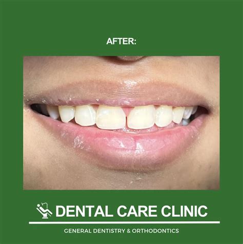 pasvil dental care clinic